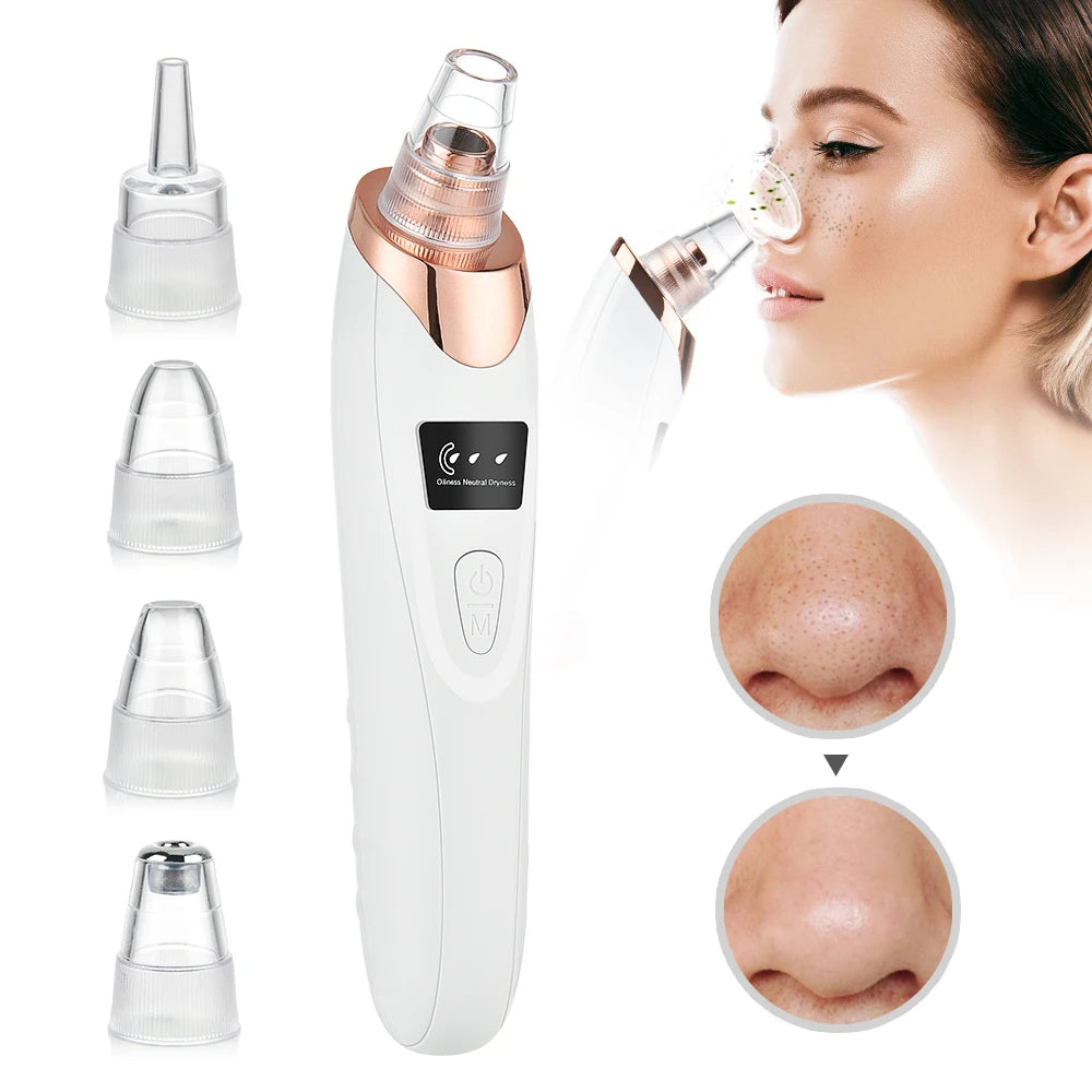 Professional Blackhead Remover Machine – 5-in-1 Electric Pore Vacuum Extractor for Deep Facial Cleansing, Acne & Whitehead Removal