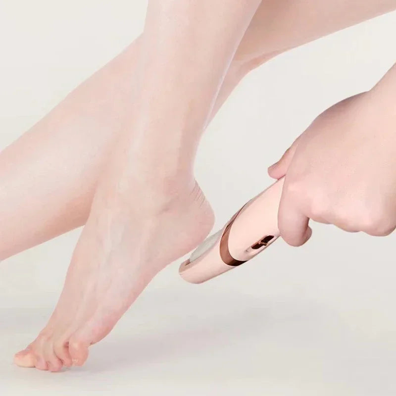 Rechargeable Foot Callus Remover – Electric Foot Scrubber for Dead Skin & Cracked Heels